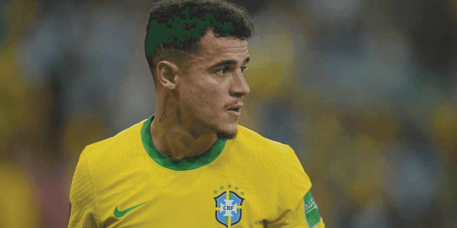 Clube catalão pode ganhar uma bolada caso uma transferência do jogador se concretize, lesão atrapalha