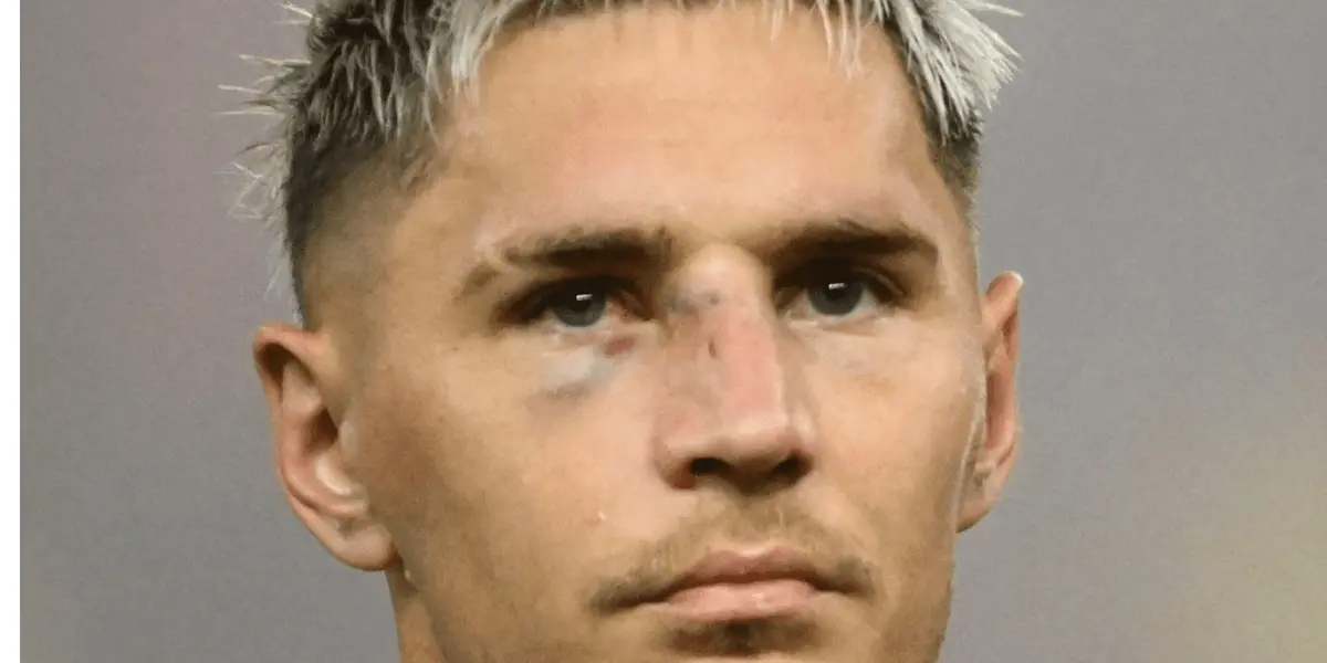 Lateral apareceu visivelmente machucado após agressão no treino