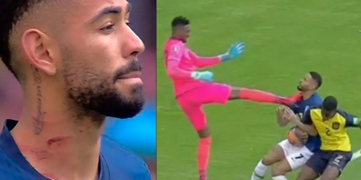 O árbitro central Wilmar Roldán recorreu ao vídeo-árbitro assistente para rever o ocorrido e perceber a gravidade da jogada.