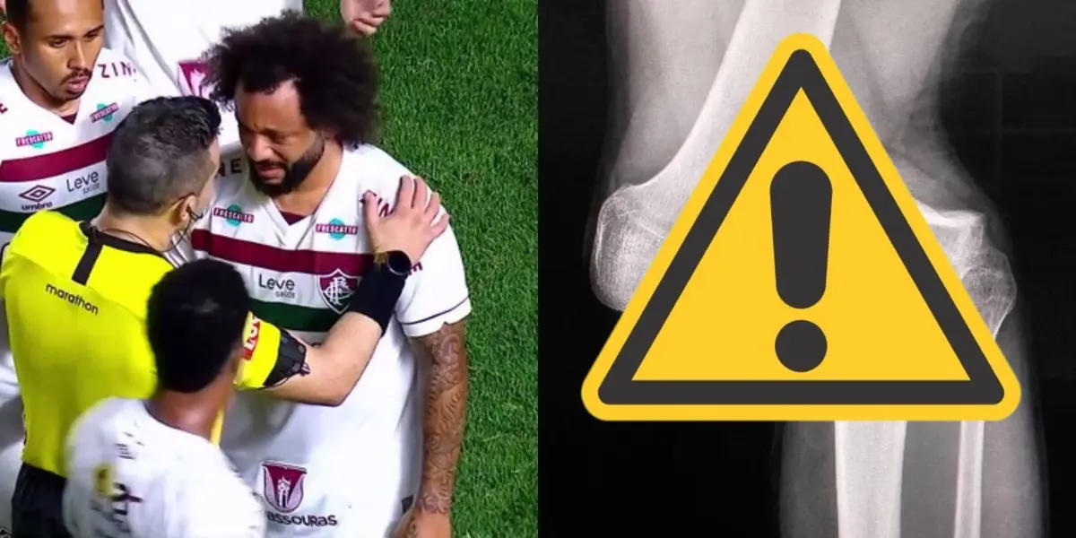 O zagueiro do Argentinos Juniors, Luciano Sánchez, sofreu uma grave lesão em um lance com o lateral Marcelo, do Fluminense